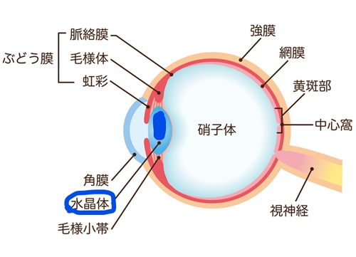 白内障断面